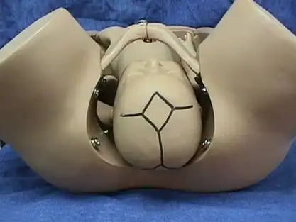 枕左横位是什么意思 枕左横位是什么意思?