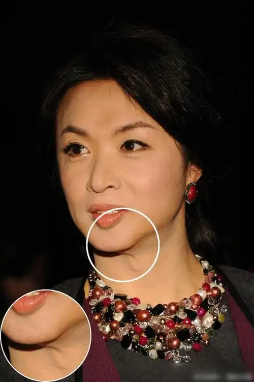 50岁金星的现状,后遗症"愈发明显"很痛苦,网友:越看越像男人