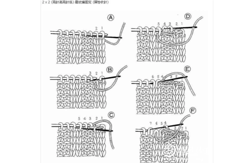 双螺纹针收针法