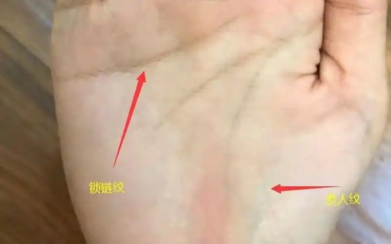 手掌掌纹岛纹(掌纹岛纹是什么意思)
