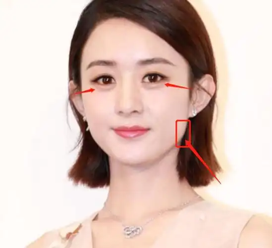 赵丽颖破除整容传闻新剧预告厚唇没了山根回凹脸还是有点方