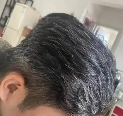 长白头发尽量不要染日常多吃这5类食物或能让白头发变少