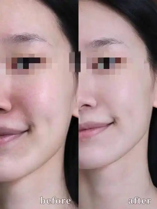 这款还是隔离防晒美白三合一的质地,隔离化妆品和粉尘对皮肤的伤害,伪