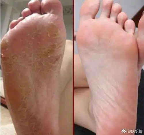 王子文的这双脚都快成国宝了33码19cm大小手都不止这个数