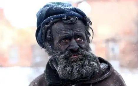 欧洲最脏的人去世 捷克男子多莱扎尔死因个人资料生前经历_国际新闻_