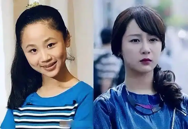 杨紫被疑整容,脸部僵硬,假面感重,网友:有点像西门大妈!_状态_成功_变