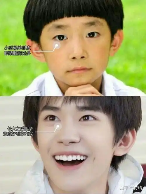 另外和小时候改变比较大的还有千玺的鼻子,小时候的千玺,鼻子有些肉肉