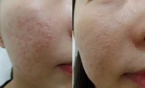 韩国陈整形医院对比