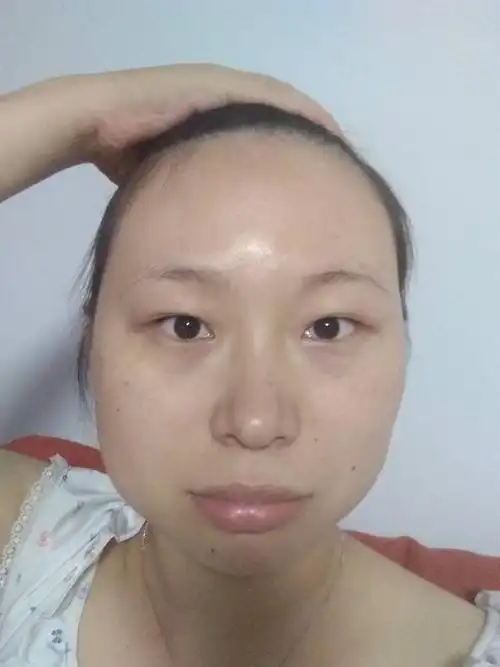 求看脸脸又大又宽斑很多眼皮浮肿有遗传性眼袋能怎么化妆好看点