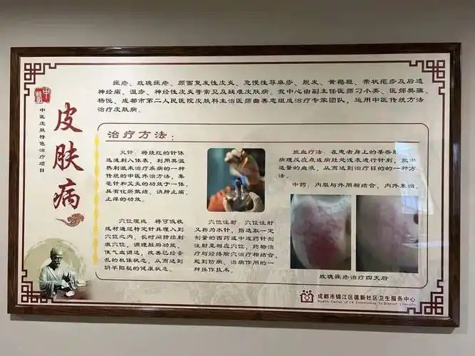 让中医皮肤在社区再放异彩——锦江区—市二医院网格化医联体工作纪实