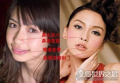 angelababy整容前后照片对比