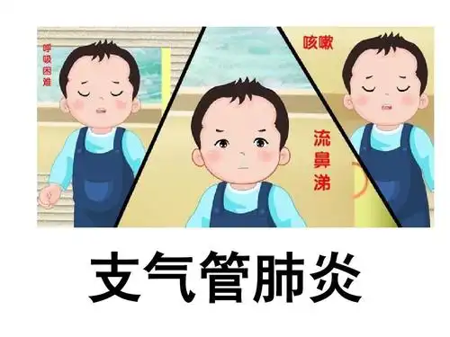 支气管肺炎 儿科护理学ppt