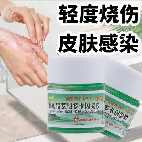 烧伤烫伤膏凝胶绿药膏皮肤感染老牌子正品林可霉素利多卡因凝胶
