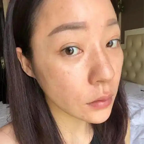 知道为什么你的皮肤暗黄吗看完你就懂了