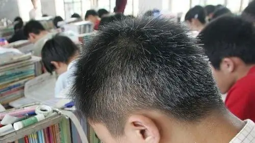 《白头发越来越多是什么原因,白头发怎么能变黑发》 如今很多年轻人