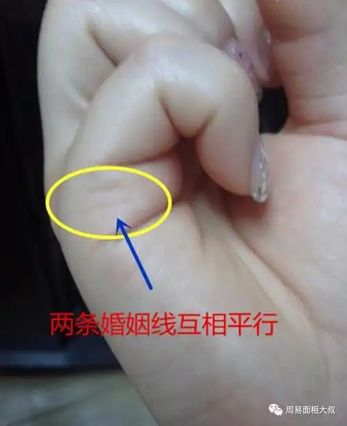 但是每段恋情都会认真对待;两条婚姻线纹路清晰,并且一样长,表示感情