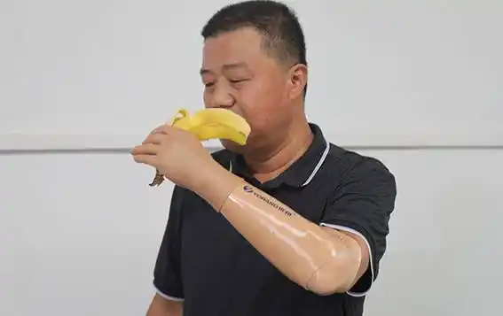 上肢假肢的分类_控制_美容_功能