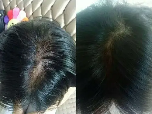 祖传纯中草药生发固发乌发液 - 美篇