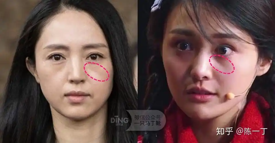 一脸苦相的容貌有何特征