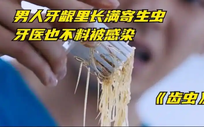 男人牙龈里长满寄生虫,牙医取出后也遭感染