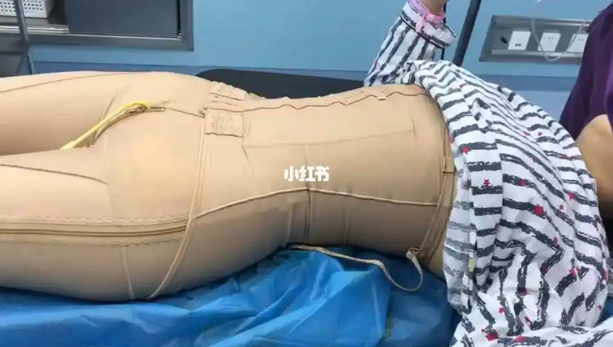 素氧腰腹环吸77大腿环吸术后效果实拍