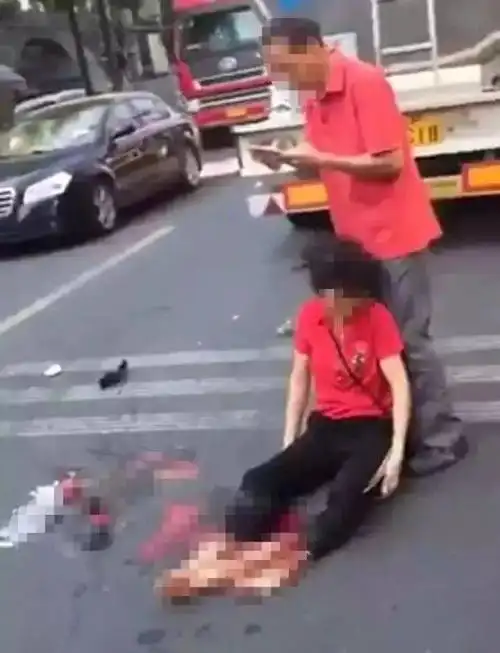 近日青田温溪发生一起严重车祸一女子双脚被货车碾压双脚几乎掉落现场