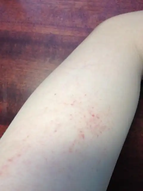 皮肤上出现红点是怎么回事 如图