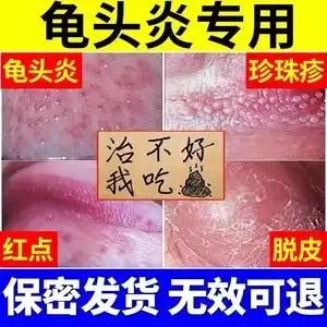 健建龟宁草本乳膏归严宁男士私处护理液龟头抑菌炎红白点止痒异味