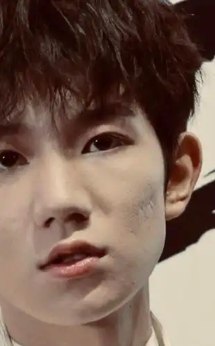 据网曝图,王源的脸似乎烂了,看看下面这几张图,组里说不像是痘坑