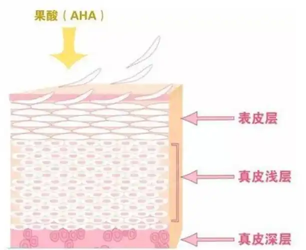 对于这种情况,如果你是耐受城墙皮,可以选择去角质的产品,例如果酸