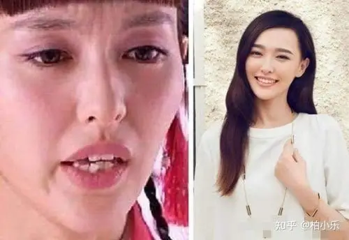 凭什么外表平平无奇的人做了牙齿矫正就变好看了