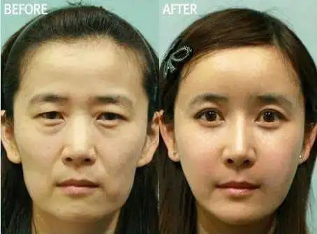 网友感叹:不愧是整容大国,美女什么的都是浮云!