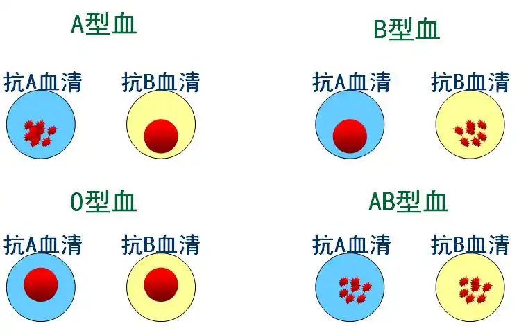 胖瘦和血型有关?"这种"血型的人,减肥或许不太容易
