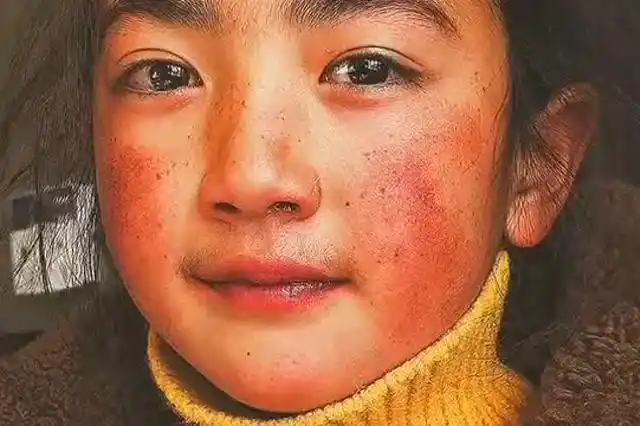 最美的高原红美中带着优雅,简直就是神仙颜值,这孩子长大还了得!