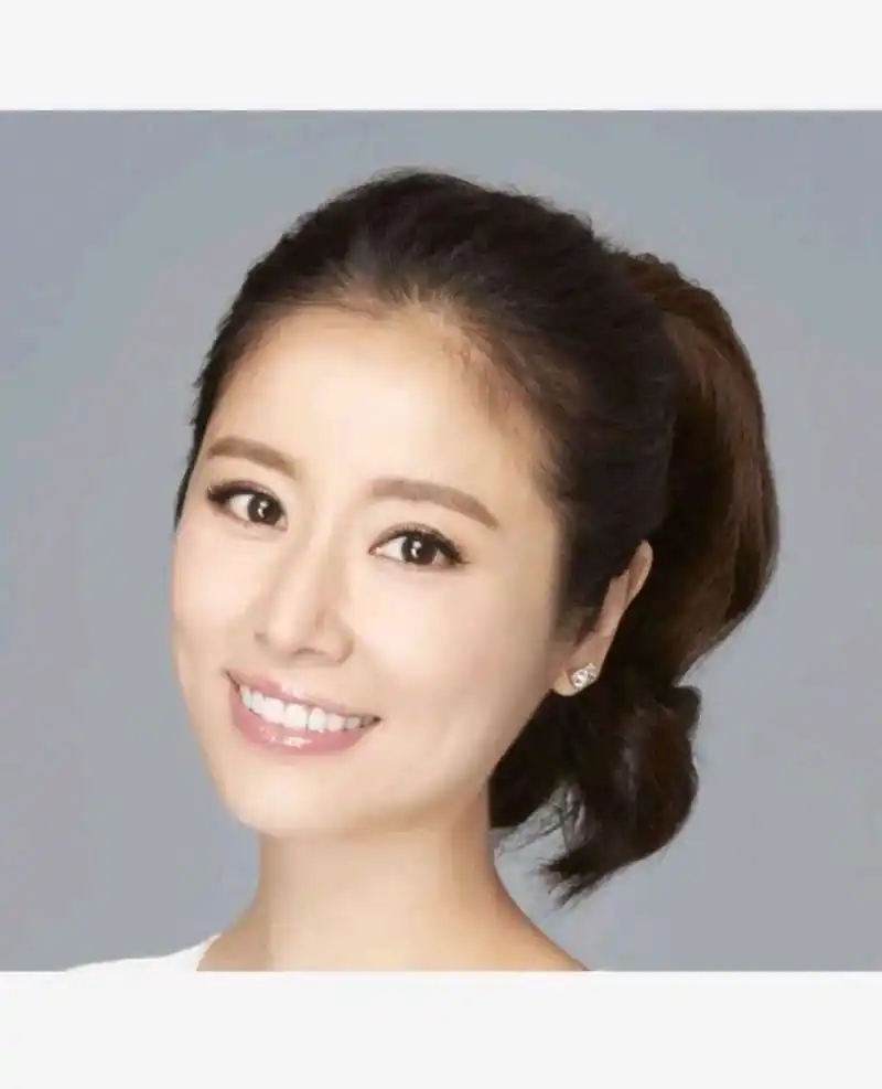 想不到林心如年轻时确实有美容过牙齿,看着真自然,原来她以前是有可爱