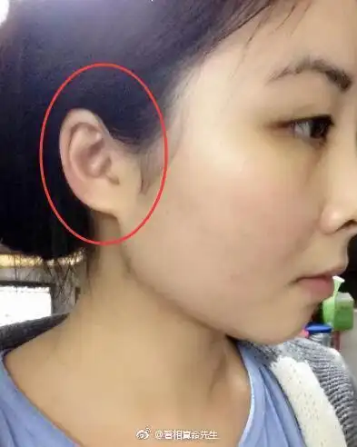 棋子耳是指双耳圆润,无尖耸不规整外形,. 来自动漫大部落 - 微博