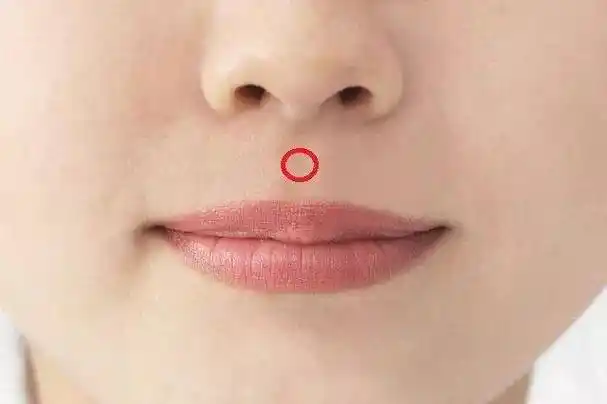 从人中诊断男女生殖系统病