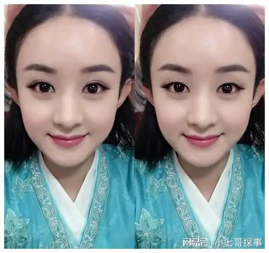 整容|单眼皮|赵丽颖|小眼睛_网易订阅