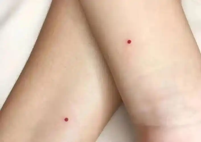 朱砂痣是什么样子