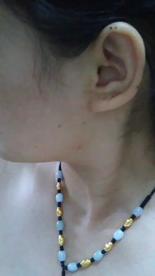 耳朵上长好多痣,这好啊好啊?