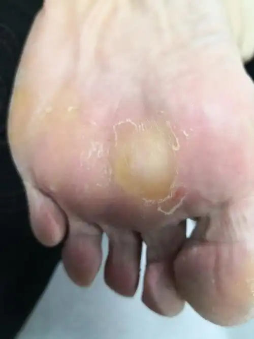 真菌##解决皮肤问题专注皮肤美容