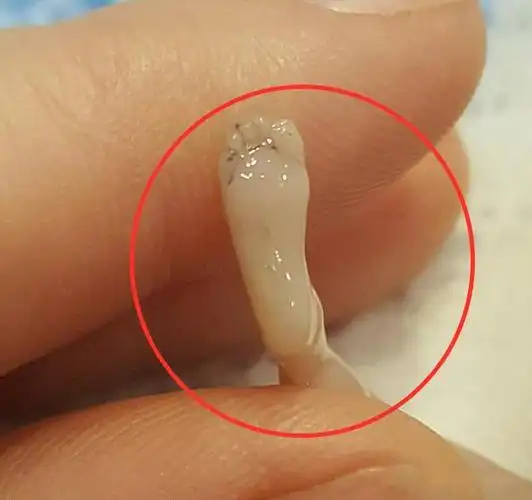 宝妈怀孕14周后流产,网上分享胎儿照片,仅10厘米但手脚都已成型-爱子