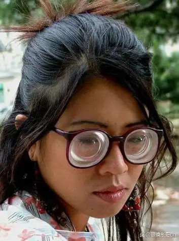 高度近视需要注意了