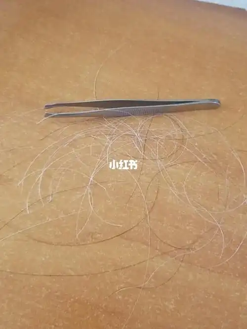 有没有人跟我一样爱这么拔白头发的