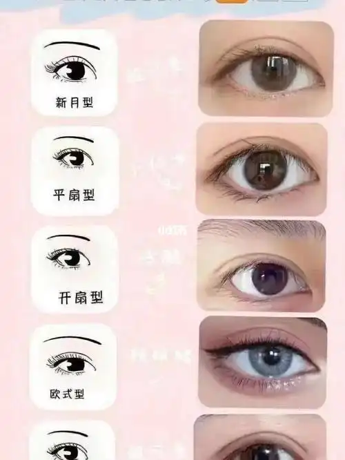 双眼皮有几种款式?