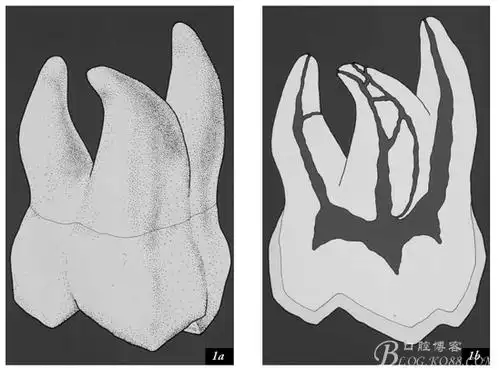 再说说我们今天要谈论的上颌第一磨牙的根管系统.