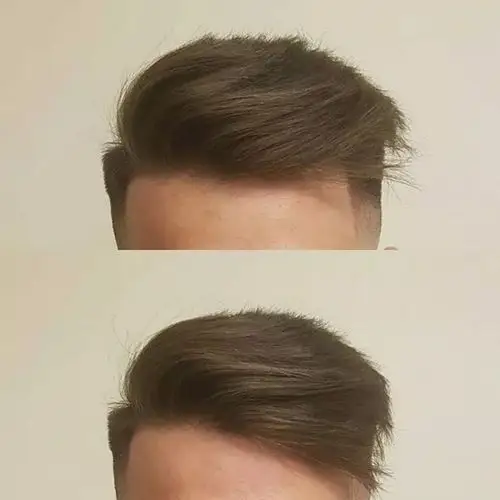 两边剪短头顶留长的男士发型的造型参考,不同头型不同造型风格二