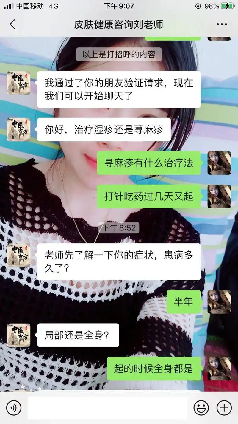 万能的抖音爸爸,你们又没有治疗皮肤过敏的好了的呀,有的推荐一 - 抖