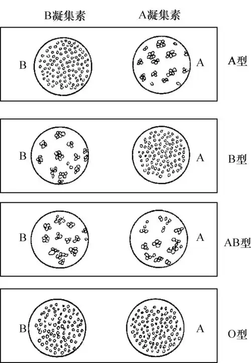 abo血型的测定