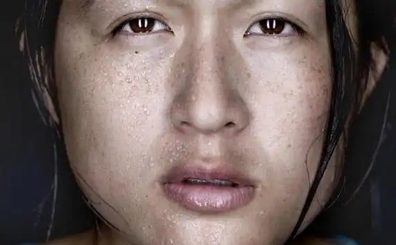 脸部浮肿该怎么办?(1)